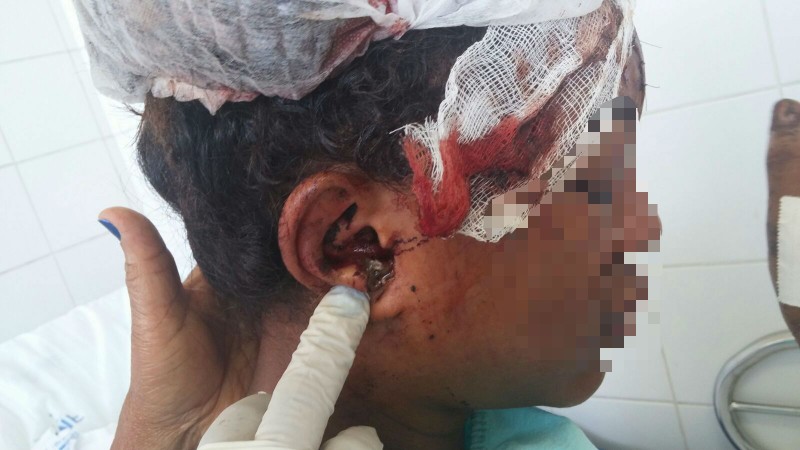 Estudante da Unifacs é preso suspeito de tentar matar a namorada