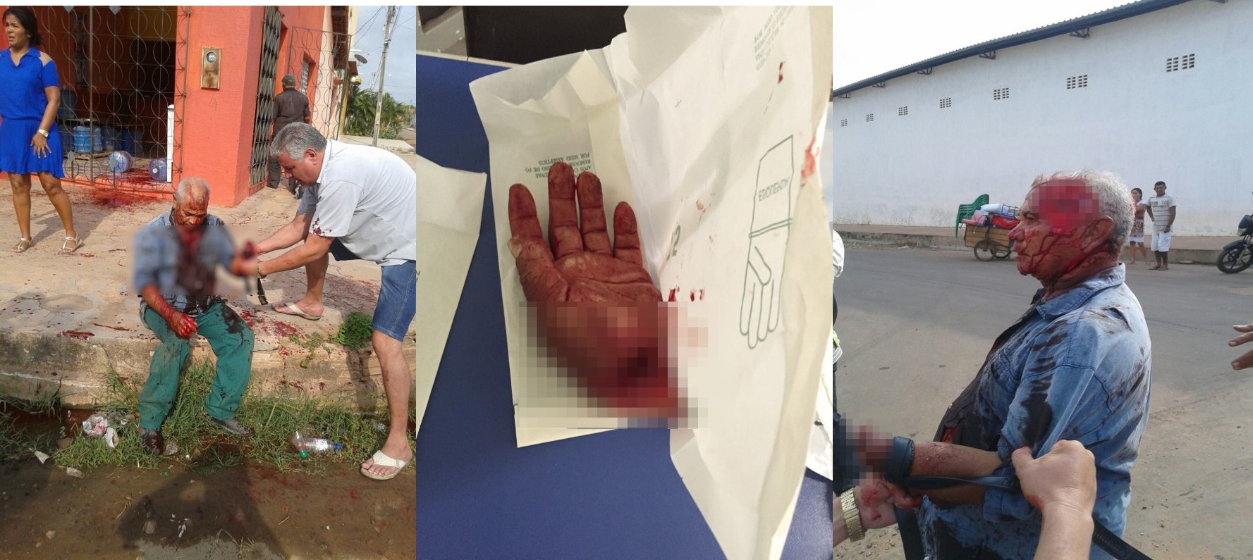 Vídeo: idosos brigam e um tem mão decepada e corte profundo na cabeça