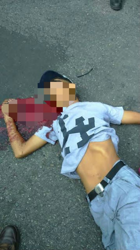 Homem é baleado no pescoço na Paralela