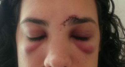 Mulher é agredida depois de “dar fora” em homem no Carnaval