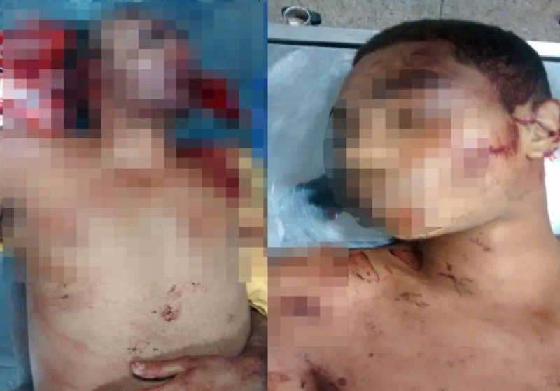 Dois morrem e três são feridos em troca de tiros com a polícia em Sete de Abril