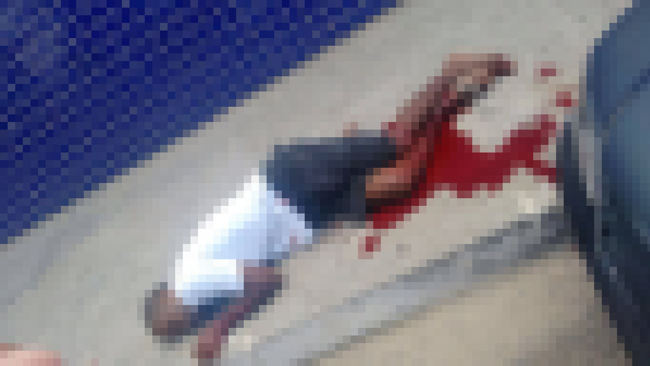 Ex-policial militar é morto em frente a UPA