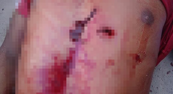 Mulher é detida suspeita de matar namorado com facada no peito