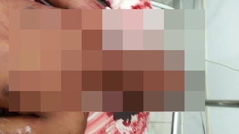 CANDEIAS: Adolescente de 16 anos morre em confronto com a polícia