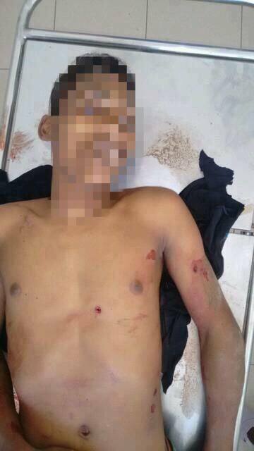 Candeias: elemento é baleado em troca de tiros com a PETO