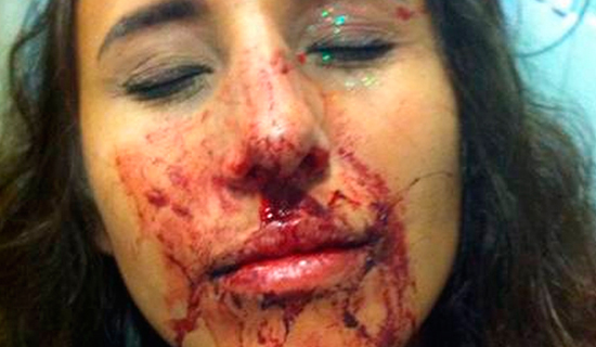 Após reclamar de assédio, foliona é agredida com murros no rosto