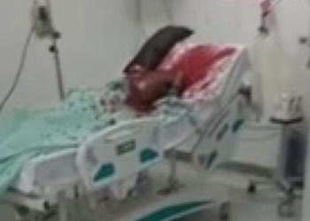Jovem tem cabeça decapitada quando estava internado em hospital
