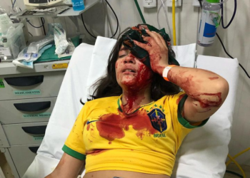 Criança de 13 anos que participava de carreata bolsonarista é agredida por apoiadores de Lula