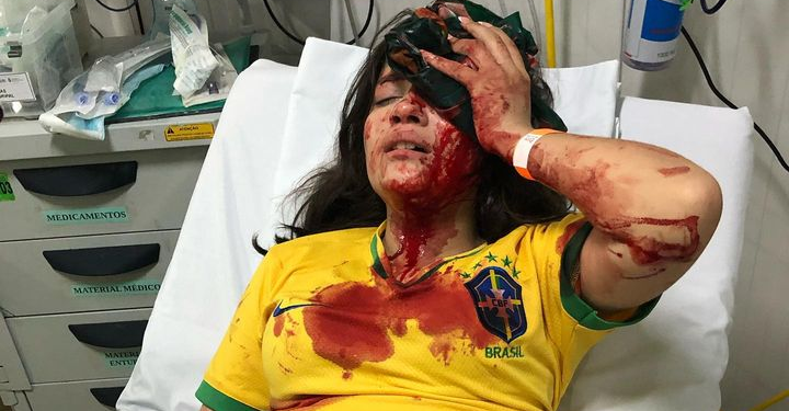 Criança de 13 anos que participava de carreata bolsonarista é agredida por apoiadores de Lula