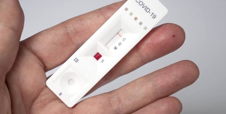 Governo Lula perdeu R$ 43 milhões em testes de Covid