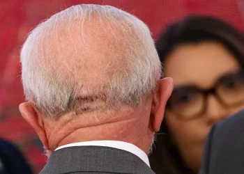 Presidente Lula passa por cirurgia de emergência após sentir dor de cabeça