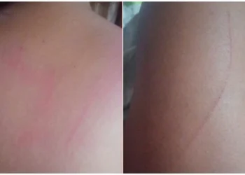 Garota de programa é estuprada por três homens após encontro marcado com falso cliente