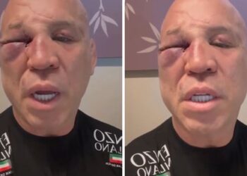 Wanderlei Silva diz que perdeu memória e está com forte dor de cabeça após luta com Popó