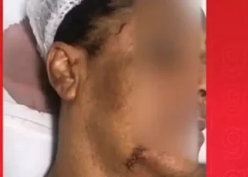 Mulher trans acusa tentativa de feminicídio em Madre de Deus; companheiro foi detido