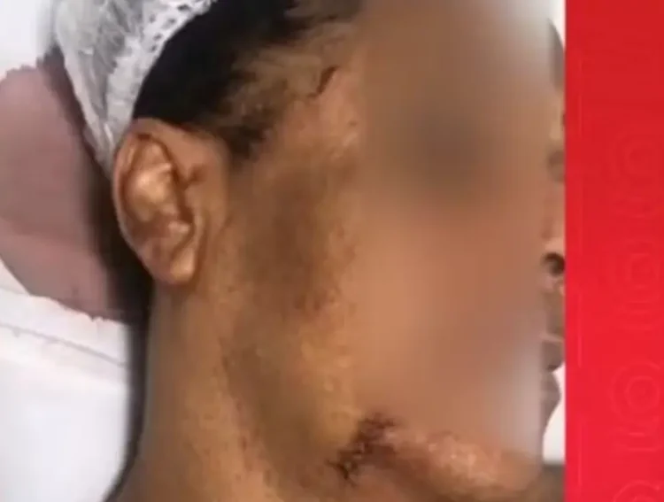 Mulher trans acusa tentativa de feminicídio em Madre de Deus; companheiro foi detido